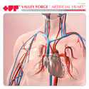 Post Thumbnail of CA040: Valley Forge | Artificial Heart